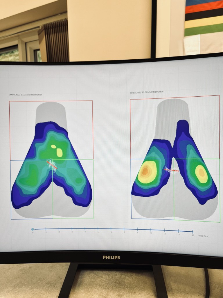 Gebiomized saddle pressure mapping